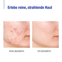 Reinigungsschaum, 150 ml