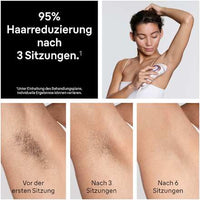 IPL-Gerät, Skin i-expert Pro IPL PL7321, 1 St