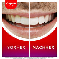 Whitening Serum Overnight, 2,5 ml Colgate