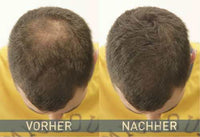 Losse haarverdikkingsmiddel donkerbruin, 14 g