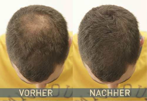 Streuhaar Haarverdichter Dunkelbraun, 14 g