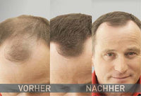 Streuhaar Haarverdichter Mittelbraun, 14 g