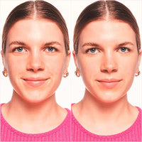 Concealer Skin Lovin' Sensitive 10 Light, 3,5 ml