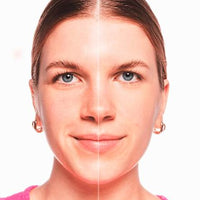 Concealer Skin Lovin' Sensitive 10 Light, 3,5 ml