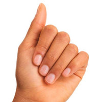 Nagelpflege 10in1 Nail Repair Strengthening Treatment, 8 ml