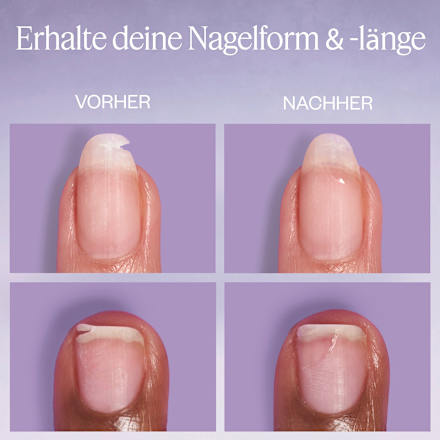 Flüssiges Nagelpflaster Break Fix, 7 ml