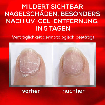Nagelhärter To The Rescue, Pflegend, 13,5 ml