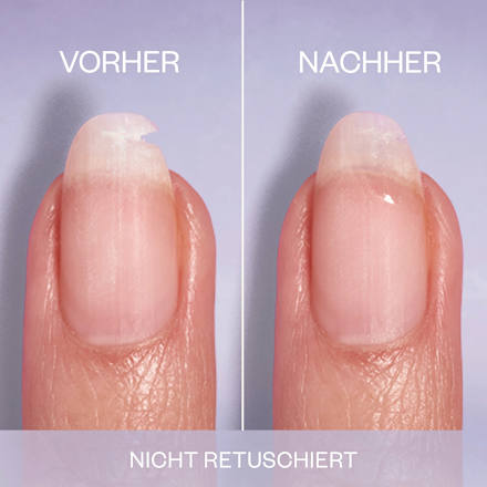 Nagelpflege Set Break Fix Nagelfixierer & On a roll Apricot Cuticle Oil, 1 St