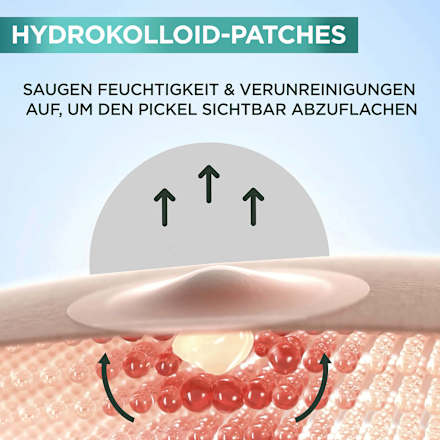 Anti-puistjes puistjespleisters hydrocolloïde, 22 stuks