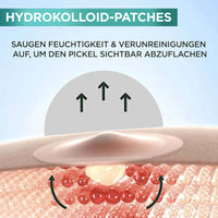 Anti-puistjes puistjespleisters hydrocolloïde, 22 stuks