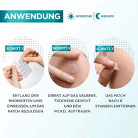 Anti-puistjes puistjespleisters hydrocolloïde, 22 stuks