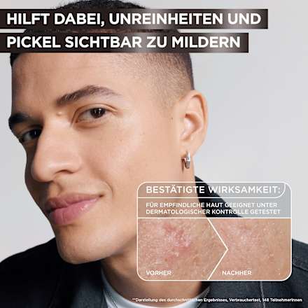Serum Anti-Unreinheiten AHA + BHA Kohle, 30 ml Garnier Skin Active