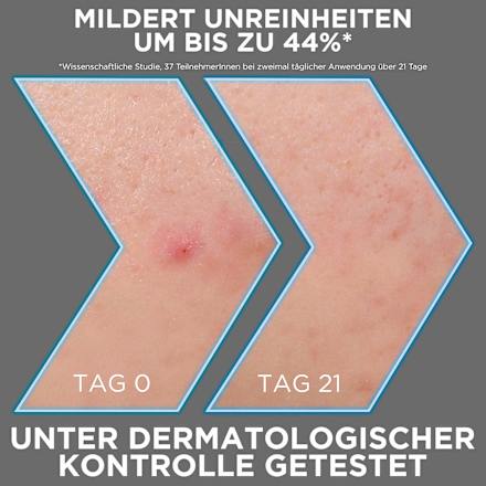 Serum Anti-Unreinheiten AHA + BHA Kohle, 30 ml Garnier Skin Active