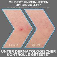 Serum Anti-Unreinheiten AHA + BHA Kohle, 30 ml Garnier Skin Active