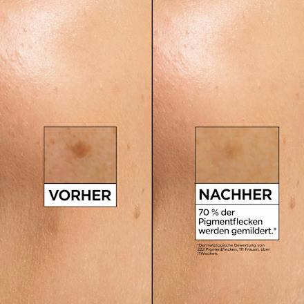 Serum Glow Booster, Vitamin C Anti-Dunkle-Flecken, 30 ml