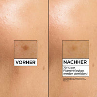 Serum Glow Booster, Vitamin C Anti-Dunkle-Flecken, 30 ml