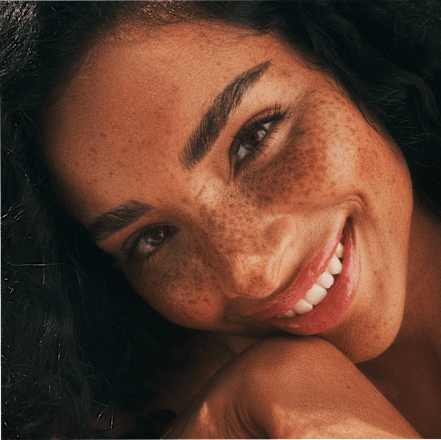 After Sun Lotion hydraterend, 180 ml