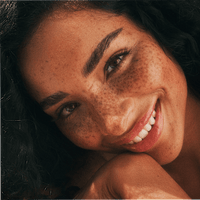 After Sun Lotion hydraterend, 180 ml