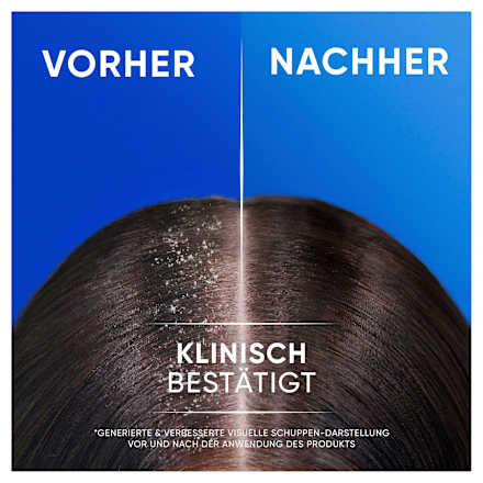 Shampoo anti-roos 2in1 Classic Clean, 250 ml