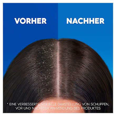 Shampoo anti-roos Apple Fresh, 300 ml