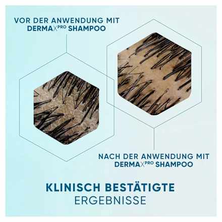 Shampoo Derma x Pro Hydra Pflege, 250 ml