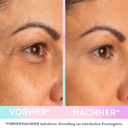 Magic Wonder Oogcrème, 10 ml