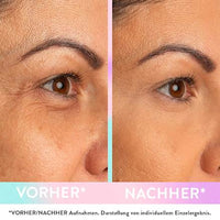 Magic Wonder Oogcrème, 10 ml