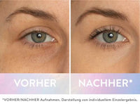 Magic Wonder Oogcrème, 10 ml