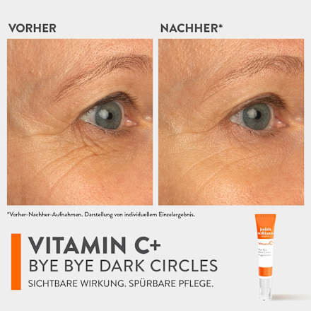 Augencreme Vitamin C+ Bye Bye Dark Circles, 15 ml