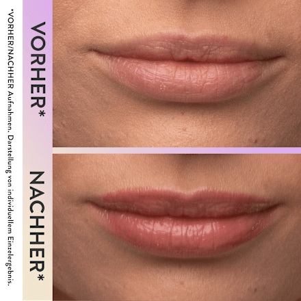 Lippenverzorging Magic Wonder Lip Boost Peptide, 4 ml