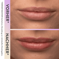 Lippenverzorging Magic Wonder Lip Boost Peptide, 4 ml