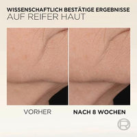 Age Perfect Mikro-Kollagen Serum, 30 ml