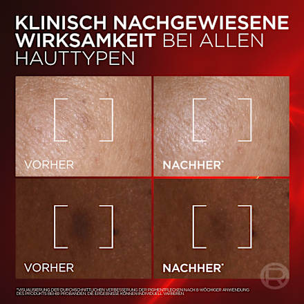 Anti Age Gesichtsserum Revitalift Laser Dreifach Laser, 50 ml