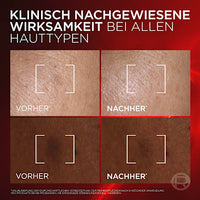 Anti Age Gesichtsserum Revitalift Laser Dreifach Laser, 50 ml
