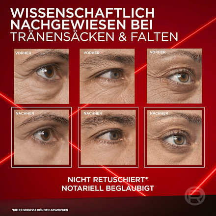 Augencreme Anti-Tränensack Laser Sofort Augenlifting, 15 ml