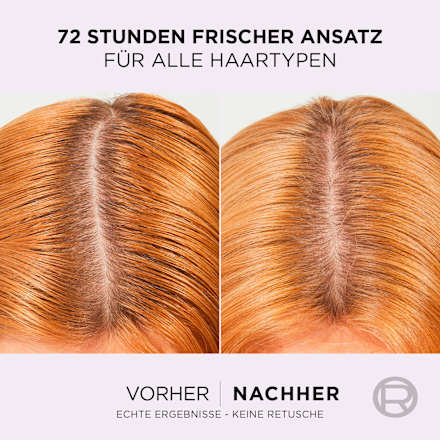 Haarserum Hydra Hyaluronic Pure, 102 ml L'ORÉAL PARiS ELVITAL