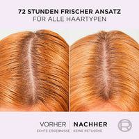 Haarserum Hydra Hyaluronic Pure, 102 ml L'ORÉAL PARiS ELVITAL