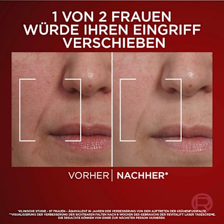 Anti Age Gesichtscreme Revitalift Laser X3 LSF 25, 50 ml