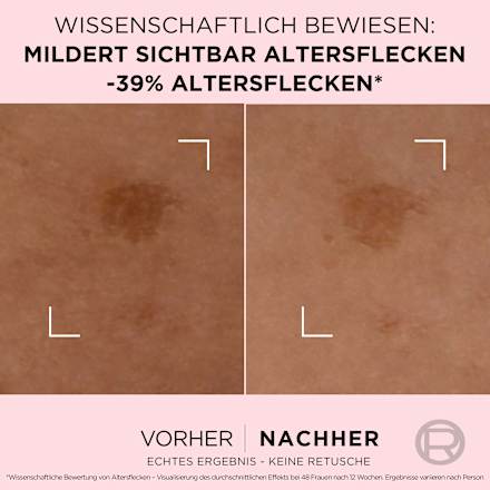 Serum Age Perfect Anti Altersflecken, 30 ml