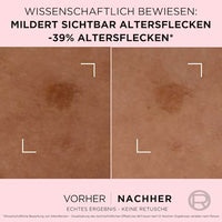 Serum Age Perfect Anti Altersflecken, 30 ml