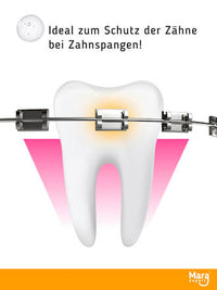 Fluoride Gelbeschermer, 25 g