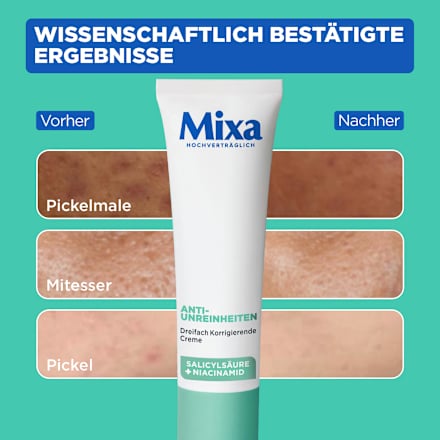 Anti Pickel Gesichtscreme korrigierend, 40 ml