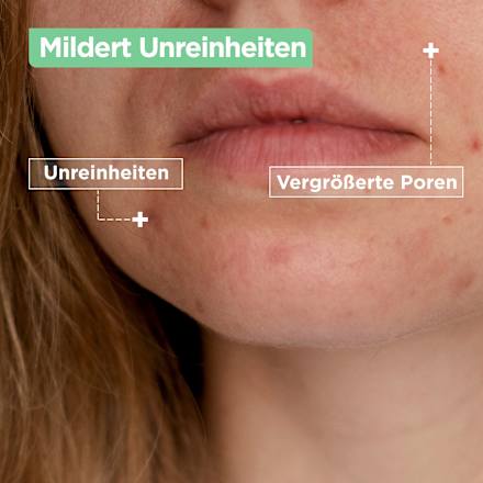 Gel-Creme mattierend Anti-Unreinheiten, 50 ml