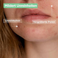Gel-Creme mattierend Anti-Unreinheiten, 50 ml