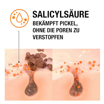Anti Pickel Feuchtigkeitscreme, 50 ml