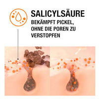 Anti Pickel Feuchtigkeitscreme, 50 ml