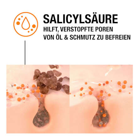 Anti Pickel Gel SOS Soforthilfe, 15 ml