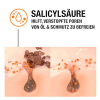 Anti Pickel Gel SOS Soforthilfe, 15 ml