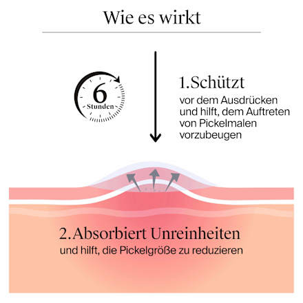 Anti-Pickel-Patches Sensitive, 30 St