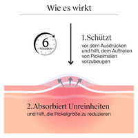 Anti-Pickel-Patches Sensitive, 30 St